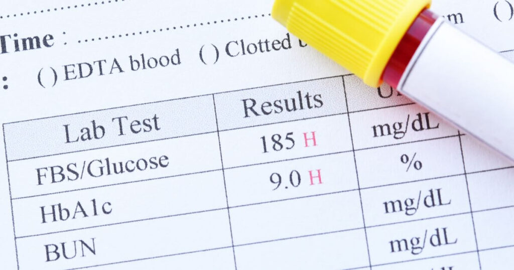 Blood-test-results